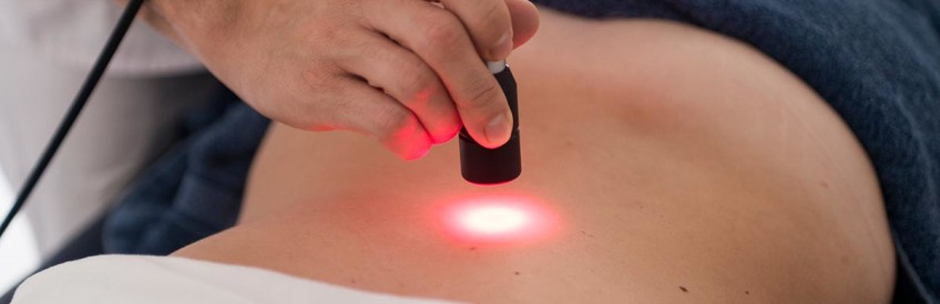 EPILAZIONE LASER A DIODI